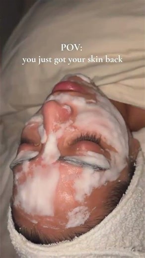 O2 Lift Facial ✨ Instant Glow Results 🤩