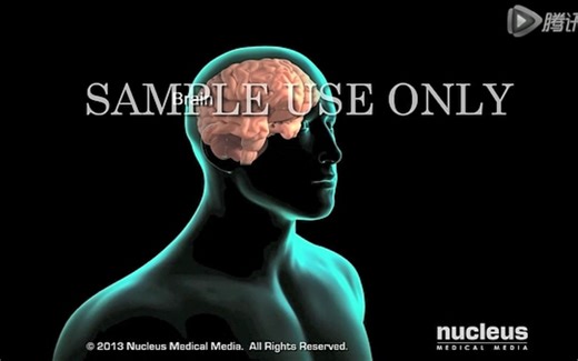 [nucleus] 去骨瓣减压术 craniectomy