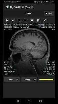 Dicom Viewer for Android