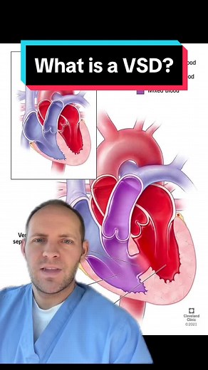 Ventricular Septal Defect: Understanding Heart Issues