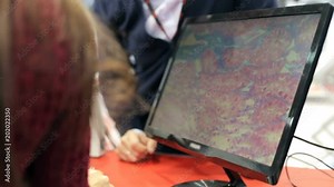 Projection of a picture from a microscope to a monitor Stock Video