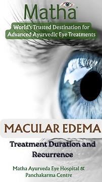 Understanding Long-Term Macular Edema Care in Ayurveda