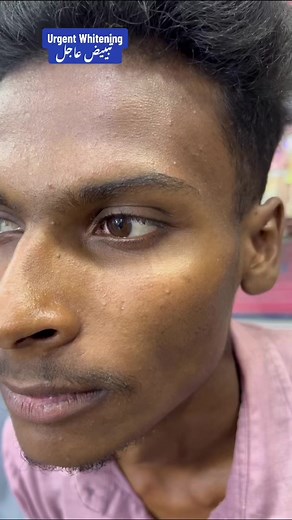تبييض فوري للوجه مع نتائج مذهلة