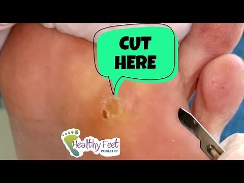 What's Inside The Waiter's Foot?