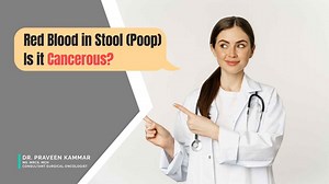 Red Blood in Stool (Poop) – Is it a Sign of Cancer