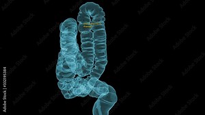 CT colonography or CT Scan of Colon 3D Rendering image showing anatomical colon for screening colorectal cancer. Check up Screening Colon Cancer. Stock Video