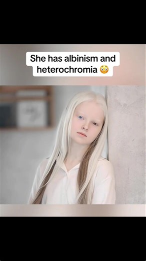 1.9K views · 21 reactions | Strange body parts womens | Jumpers Mysteries | Facebook