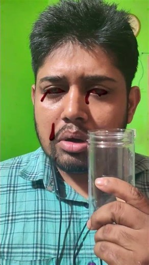 Funny Blood Drops Prank🩸🤣 | Epic Reaction 😍 #shorts #prank #funny #blood #tiktok #funnyvideo #asmr
