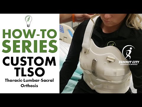 Custom TLSO: How-To Series (Thoracic-Lumbar-Sacral Orthosis)
