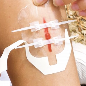 Don’t Panic! Quick First Aid Hacks That Actually Work 🩹⚡ | 5-Minute Crafts Like