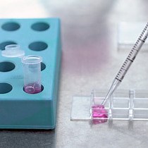 Video: Simultaneous Measurement of Mitochondrial Calcium and Mitochondrial Membrane Potential in Live Cells by Fluorescent Microscopy
