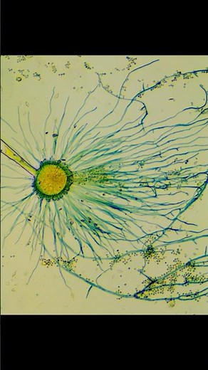 Así se identifican hongos filamentosos 🍄#biotecnologia #biologia #hongos #fungi #micologia #ciencia