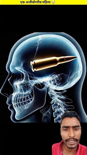 The Mystery of the Woman Hit by a Bullet! #Mystery #History #facts #shorts