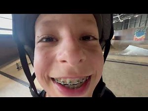 NKD GOAT – The Ultimate Stunt Scooter for All Ages | Ride Like a Pro