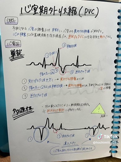 心電図の基礎と勉強法