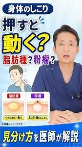 そのしこり押すと動く？脂肪腫と粉瘤の見分け方を医師が解説 #脂肪腫