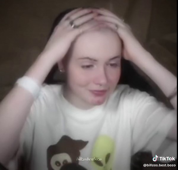 Billzo's Iconic Baldzo Transformation