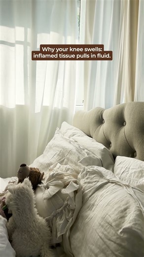 Knee Swelling & Fluid