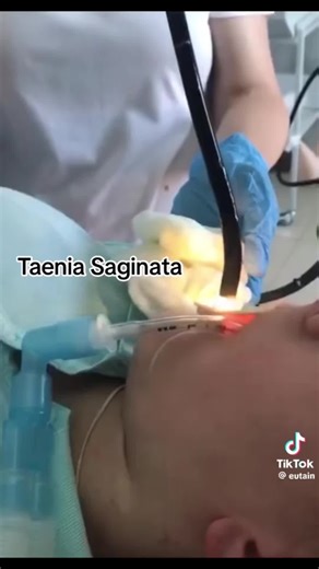 Soy especialista en fitoterapia, herbolaria y sobrepeso puedo ayudarte a mejorar tu salud naturalmente #lima #trujillo #piura #arequipa #tacna @peruanos @latinos