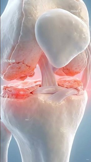 What Really Causes Joint Pain 🦴 3D Medical Animation #shorts