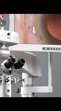 Takagi Operating Microscope OM-9@TAKAGI Ophthalmic Instruments