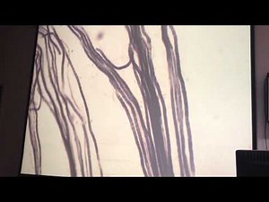 Myelinated nerve fibers