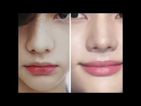 Hyunjin Plastic Surgery - Stray Kids - K-POP