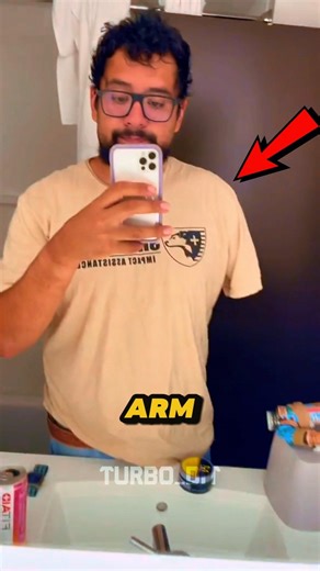 He Lost His Arm… Then Built a Bionic One 💪