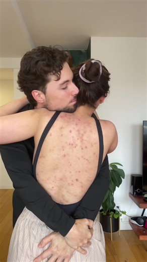Amor propio en parejas y su influencia en los perros