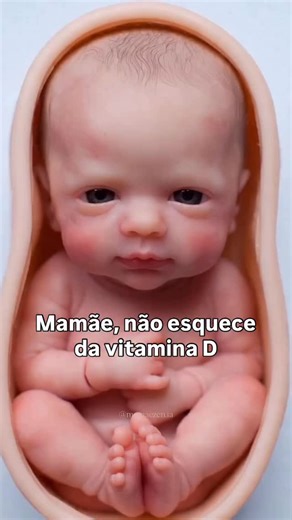 Nutricionista de gestantes | CRN5 19530 on Instagram: "A vitamina D é pequena no frasco, mas enorme na gestação. Níveis adequados ajudam a prevenir baixo peso ao nascer, parto prematuro, pré-eclâmpsia e diabetes gestacional, além de serem essenciais para a formação dos ossos, músculos e imunidade do bebê. A deficiência é comum e, muitas vezes, a alimentação sozinha não é suficiente. Por isso, exposição solar segura e suplementação orientada fazem parte de um pré-natal bem cuidado 🤍 ✨ Quer enten