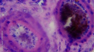 Pancreas. Microanatomy. Pancreatic biopsy section. 1000x times magnification. Digestive enzyme channels. Extrasecretory (exocrine) and intrasecretory (endocrine) functions
