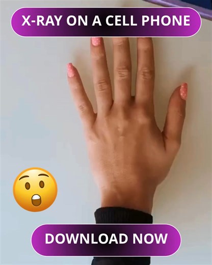 💥 This viral app shows what nobody expected! Thousands have already tested the "fake X-ray" of the moment 😂 Download it for free and record your own video now! | Tech App