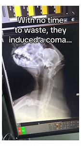 Man saves cheetah and watched over its baby as it heals. #animals | StoryTime