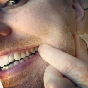 11K views · 161 reactions | Ummmm...so what do you do when your teeth just start falling out of your face? Not asking for a friend. Asking for me. Because it just happened to me. #fail #teeth #dentist #dentalhygiene #whattheheck #videooftheday #help #helpme # | The Steve Patterson | Facebook