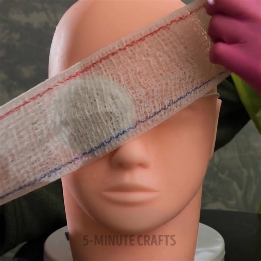 330K views · 710 reactions | First aid hacks everyone should know ! 欄 | 5-Minute Crafts | Facebook
