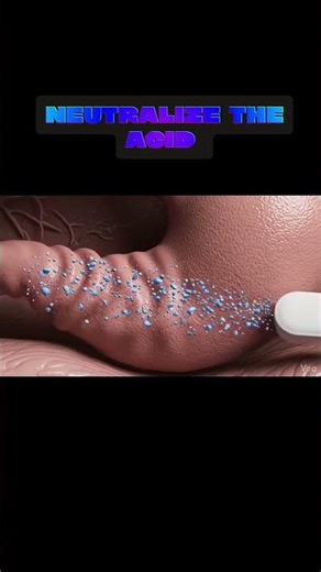 Mechanism of Action of Antacids | How Antacids Relieve Acidity | pharmacology #shorts