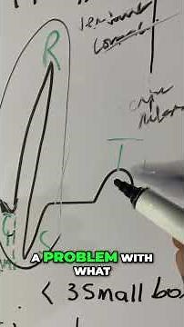 "Decoding EKG Waves: QRS & T Explained"