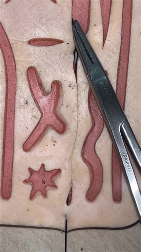 Suture Skills for Surgery: Essential Techniques and Tips