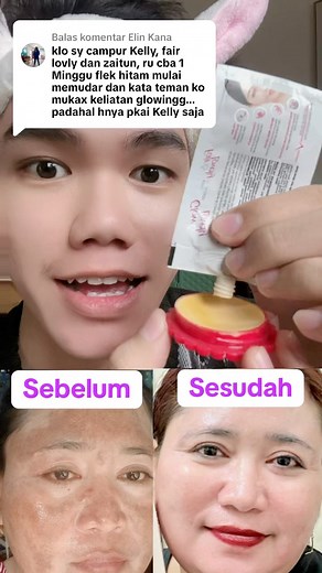 1.2M views · 5.3K reactions | Flek hitam di wajah pudar pakai 2 bahan ini. #tutorial #flekhitam #tipskecantikan @sorotan | Rinjani Norobay Girsang | Facebook