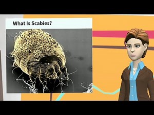 Scabies 👉 Symptoms, Cause, and Treatments