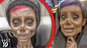 80K views · 1K reactions | Top 10 Botched Plastic Surgery That Ruined Celebrities - Part 2 | Beyond The Screen | Facebook