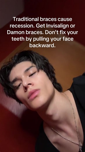 Choosing Between Traditional Braces and Invisalign