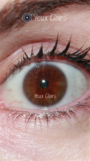 Brighten Your Look with Yeux Clairs Laser Eye Color Change