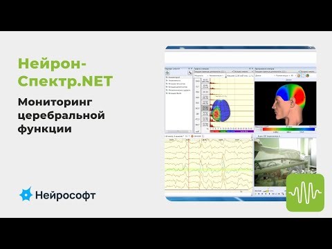 Возможности ПО «Нейрон-Спектр.NET» для мониторинга церебральной функции новорожденных