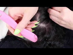 SCRATCHING MY BOYFRIENDS DANDRUFF / SCRAPING DANDRUFF / HEAD SCRATCHING WITH LONG NAILS & LICE COMB