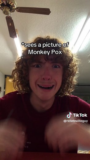 Understanding Monkeypox Transmission and Global Impact
