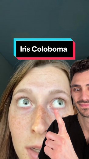 Discover the Fascinating World of Iris Coloboma: Rare Eye Condition Explained