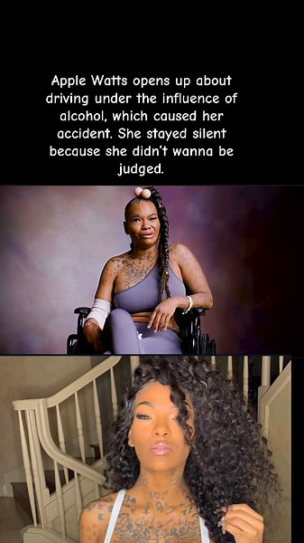 Apple Watts Discusses Her Recovery Journey After Accident