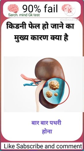 Top 50 ✍️ IAS Question🔥💯,,,GK Question and Answer|Part-0295#gkfacts​​#staticgk​​ #bkgkstudy​​ #gk