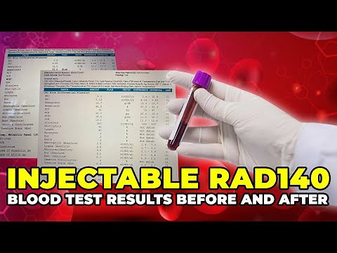 Injectable RAD140 Blood Test Results Before And After - Injectable SARMs Research